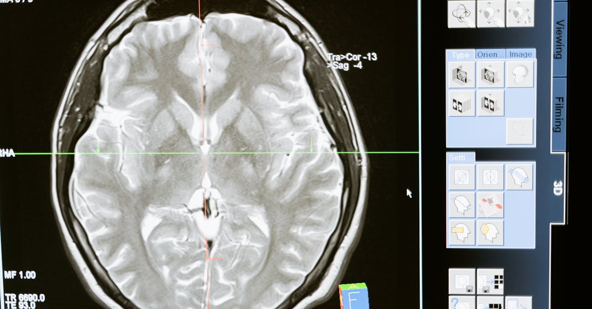 What are examples of neurogenetic diseases?